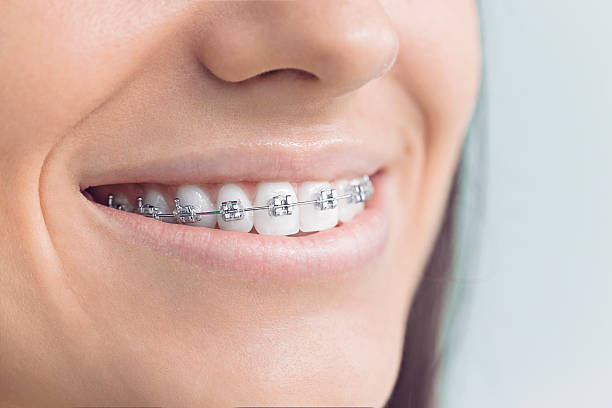 Best Root Canal Treatment  in Lake Holiday, VA